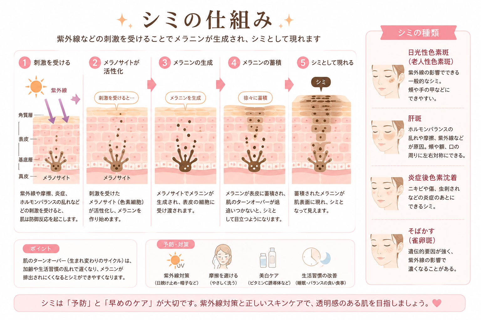 シミの仕組み ― 紫外線などの刺激でメラノサイトがメラニンを生成し色素沈着として残る図解 ― 美容皮膚科ティファクリニック 横浜院