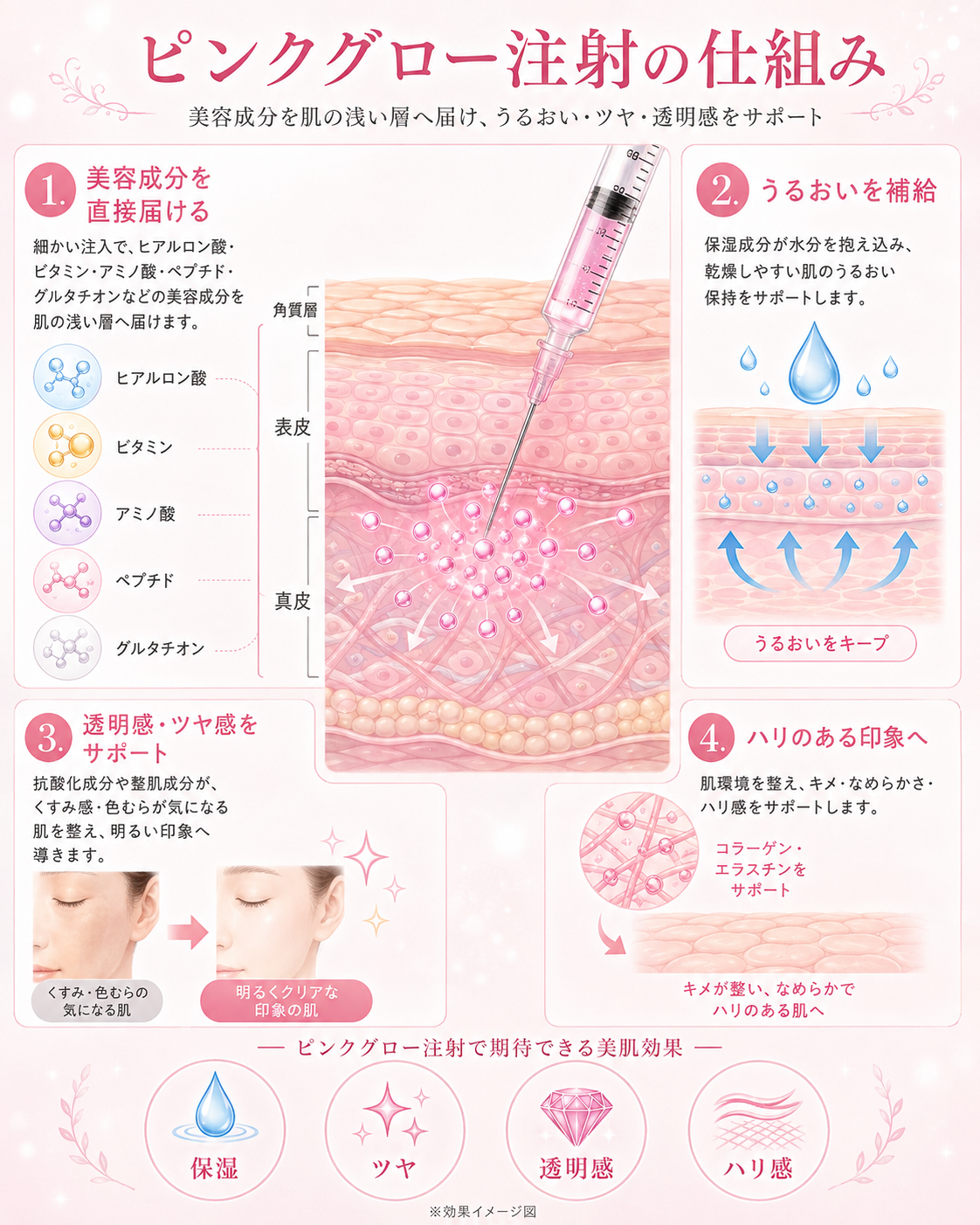 ピンクグロー注射の仕組み ― 美容成分を肌の浅い層へ届ける図解 ― 美容皮膚科ティファクリニック 横浜院