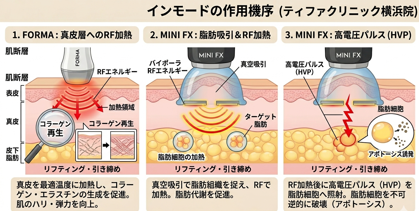 インモード（InMode）作用機序イラスト ― Forma・miniFXの仕組み ― 美容皮膚科ティファクリニック 横浜院