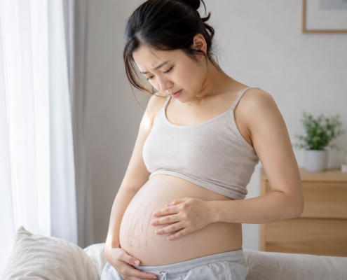 妊娠線を気にする女性の画像