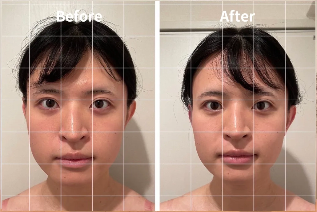 ビフォーアフター②