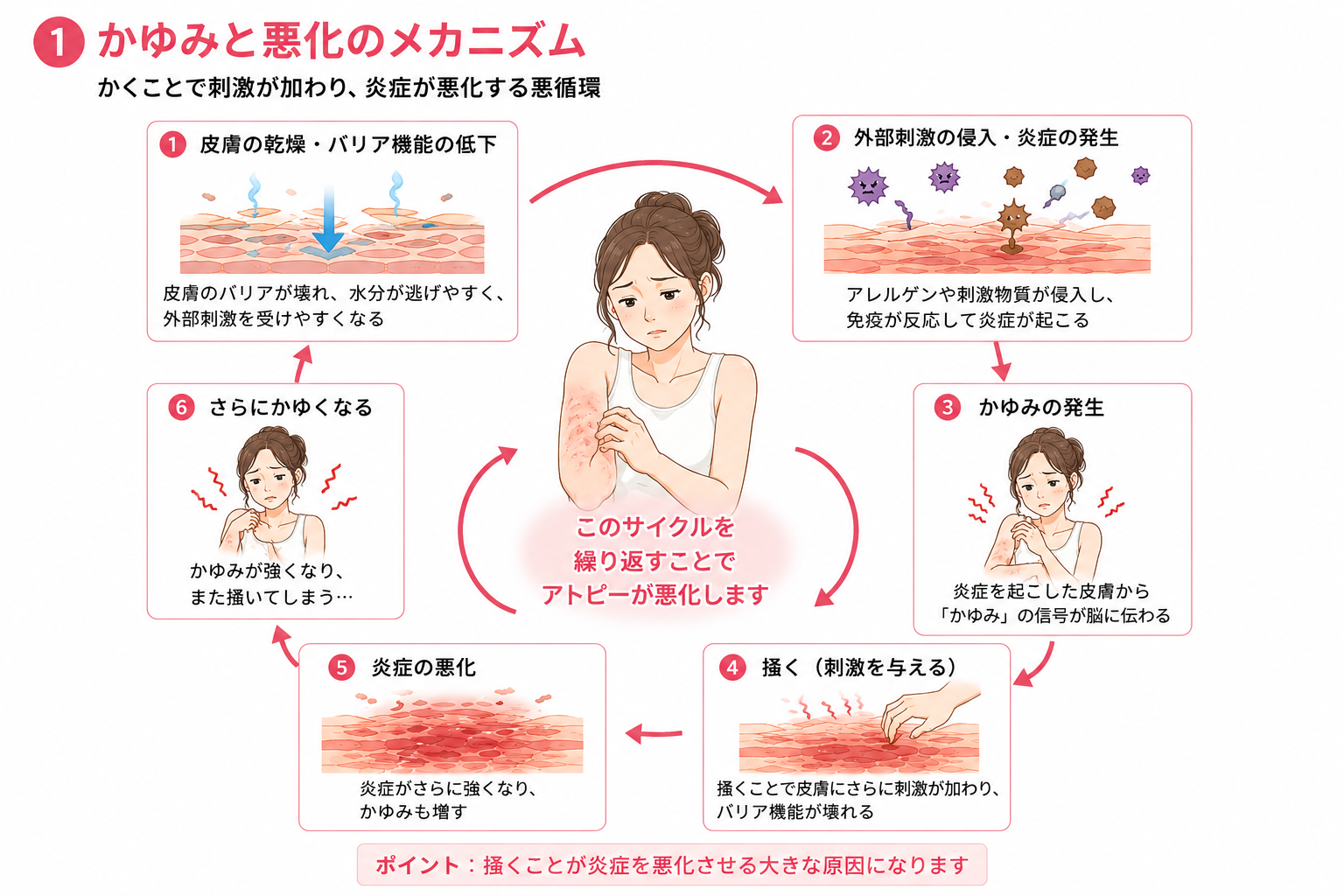 乾燥や皮膚バリア機能低下からかゆみと掻破が繰り返され炎症が悪化するメカニズム