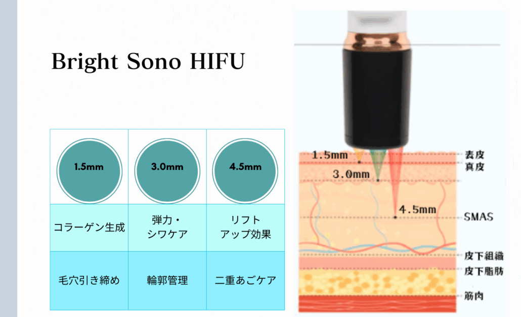Bright Sono HIFU