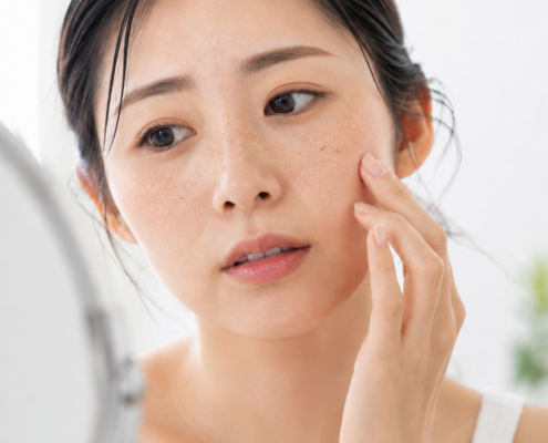 そばかすを少し気にする女性