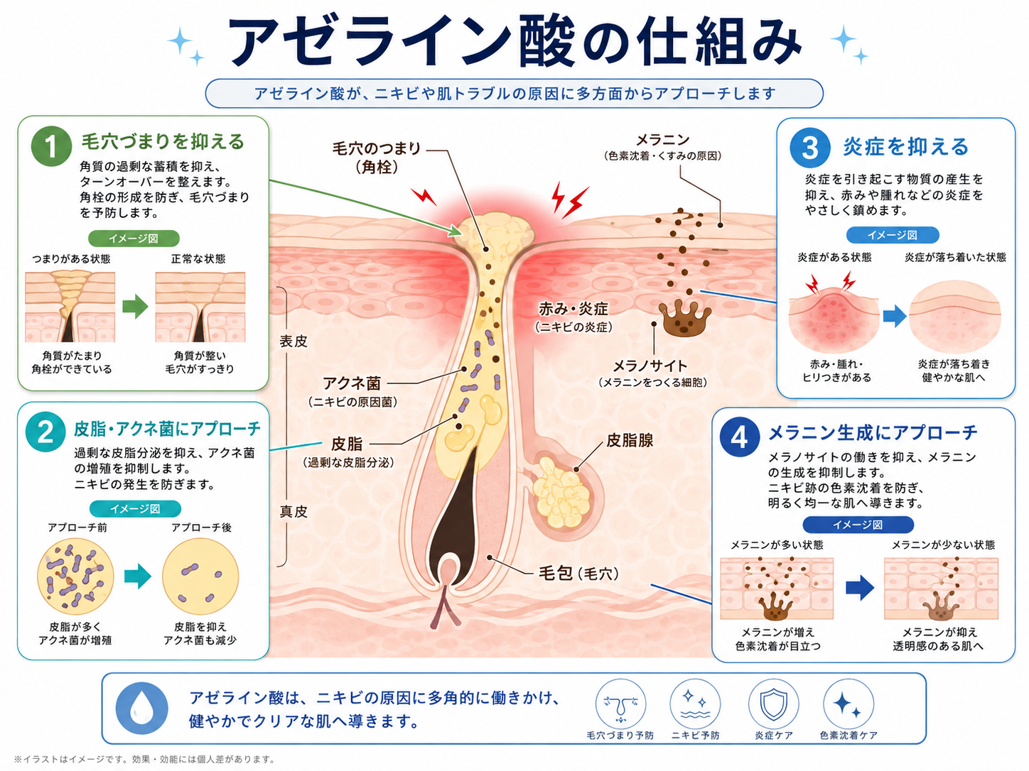 アゼライン酸 ― 美容皮膚科ティファクリニック 横浜院